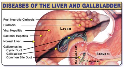 FLUSH - Liver/Gallbladder - MILDER VERSION 1